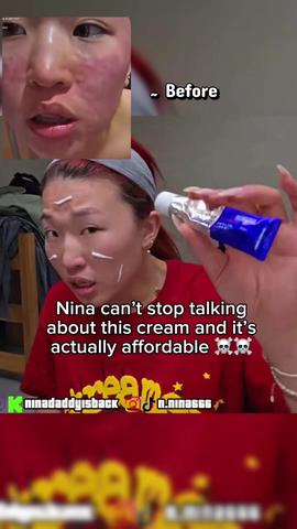 #paircream #pair #acne #nina #skincare 