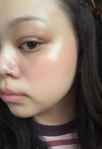redness and breakouts + so much texture was a crazy combo but we made it 😭 #skincare #japaneseskincare #acne #texturedskin #redness 